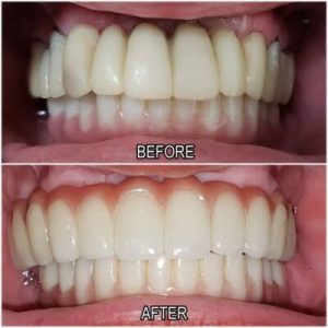 dentistry before and after